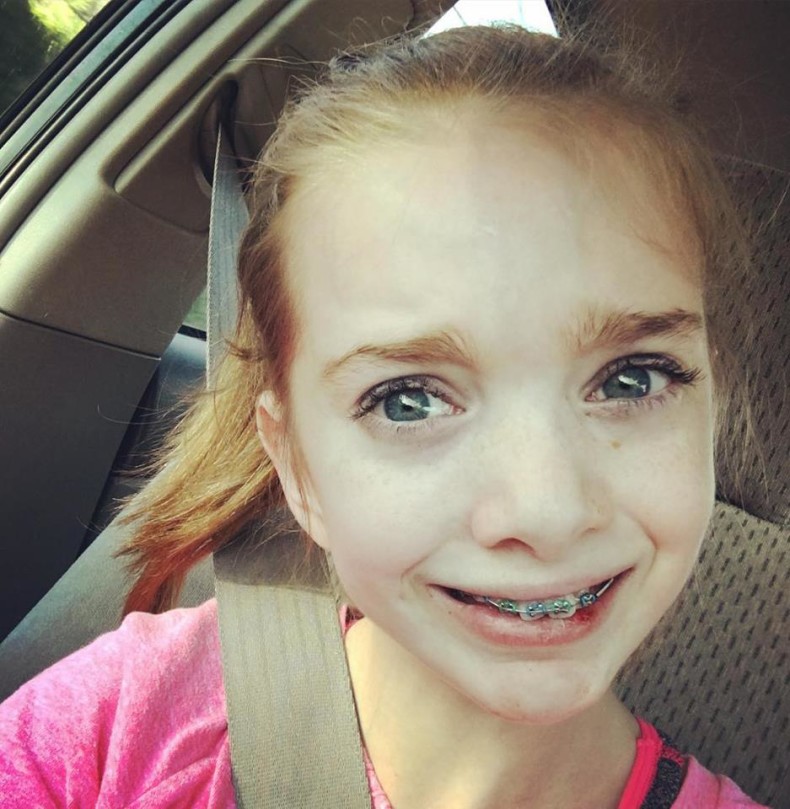 5_minutes_after_she_got_her_braces_on